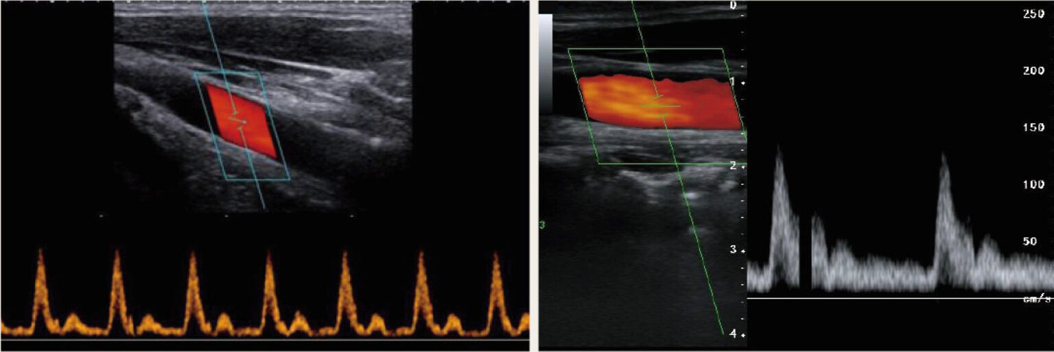 Advanced Design Full Digital Color Doppler Ultrasound System - Narula ...